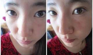 鼻子变挺的方法按摩（鼻子变挺的方法按摩法）