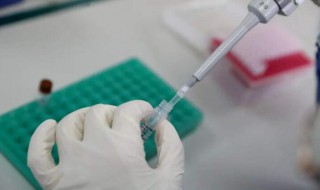 核酸检测前后注意什么（核酸检测前后注意什么细节）