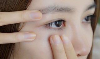 眼皮跳是什么原因怎么办 男人眼皮跳是什么原因怎么办