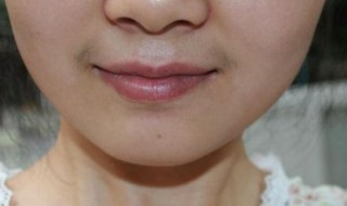 女生如何淡化唇毛（女生如何淡化唇毛最有效）