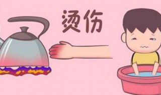 被火烫了怎么解决（被烫烧了怎么办）