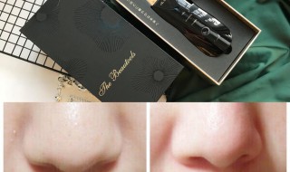 黑头一直不挤会怎样 挤了黑头有个小洞会自愈合吗