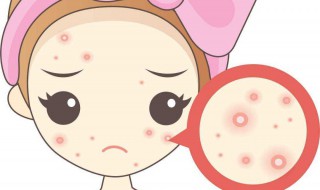 痘印怎么去除最有效（痘印怎么去除最有效的方法女生）