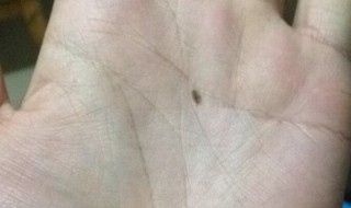 掌心有痣代表什么 左手掌心有痣代表什么