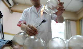 拔罐出水泡怎么回事（拔罐出水泡怎么回事 该怎么处理）