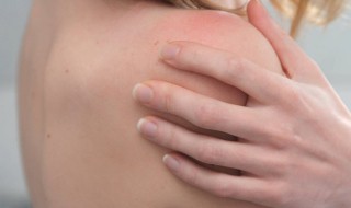 怎样驱赶人身上的跳蚤 怎样驱赶人身上的跳蚤虫