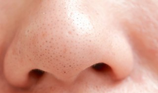 黑头是怎样产生的 挤了黑头有个小洞会自愈合吗