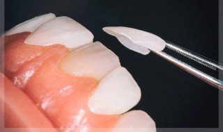 美白牙齿最有效的方法 黄牙齿怎么快速变白