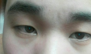 5分钟去黑眼圈小方法 眼袋大最简单的去眼袋的方法