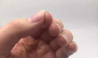 手指甲没有月牙正常吗 有的人手指甲没有月牙正常吗