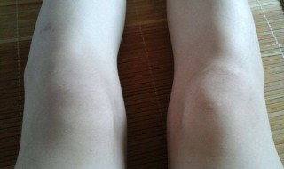 让膝盖变瘦的方法 让膝盖变瘦的方法