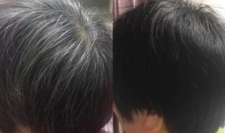 天然染黑发的方法 天然染黑发的方法图片