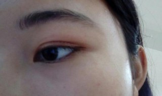 怎样贴双眼皮贴（眼皮下垂怎样贴双眼皮贴）