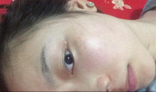 斑怎样才能清除 斑怎么才能去掉